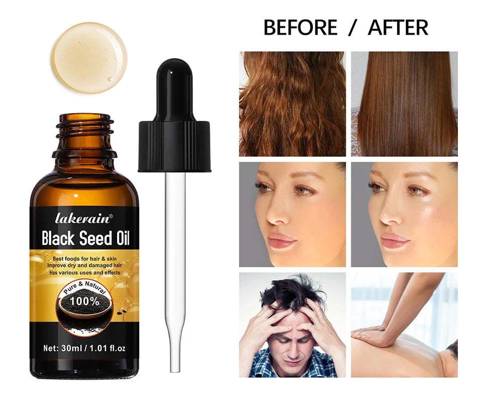 30ml Natural Black Seed Oil Serum Improve Dry&Frizzy Nourish And Repair Damaged Hair Essential Massage Oil Smooth Hair Skin Care