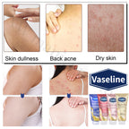 Vaseline Glutamine Whitening Body Lotion Highly Concentrated Niacinamide Hyaluronic Acid Brightens Skin Deeply Hydrating 330ml